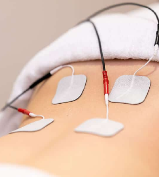 Dry Needling 2